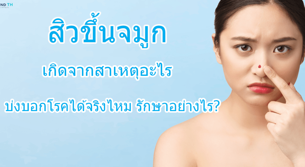 สิวขึ้นจมูก เกิดจากสาเหตุอะไร บ่งบอกโรคได้จริงไหม รักษาอย่างไร?